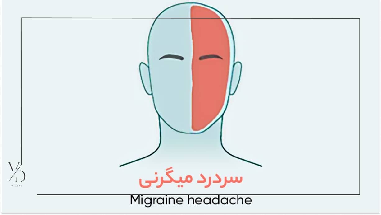 سردرد میگرن و میگرن چشمی