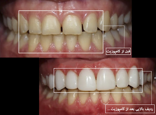  کامپوزیت چیست ؟ 